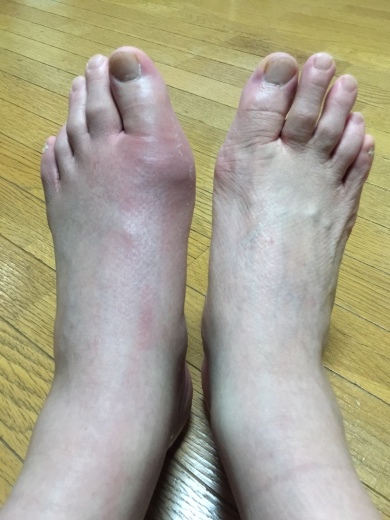 サードオピニオンに感謝_f0076731_23273311.jpeg