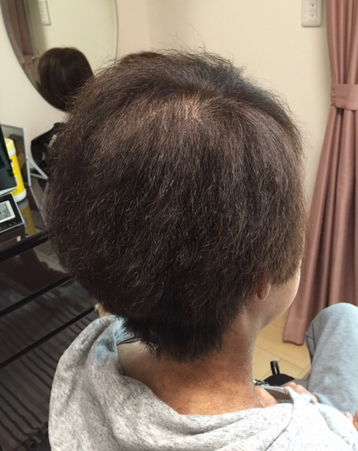 抗がん剤治療終了後のカラーリング 三重県 訪問美容 医療用ウィッグ 訪問美容髪んぐのブログ