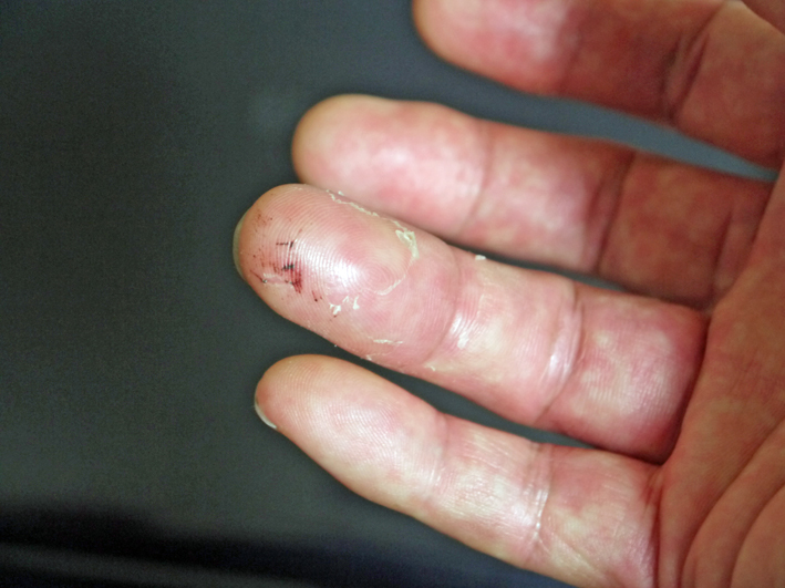 9 14左手で箸を使う練習継続中 右手薬指骨折 北鎌倉湧水ネットワーク