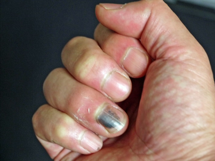 9 14左手で箸を使う練習継続中 右手薬指骨折 北鎌倉湧水ネットワーク