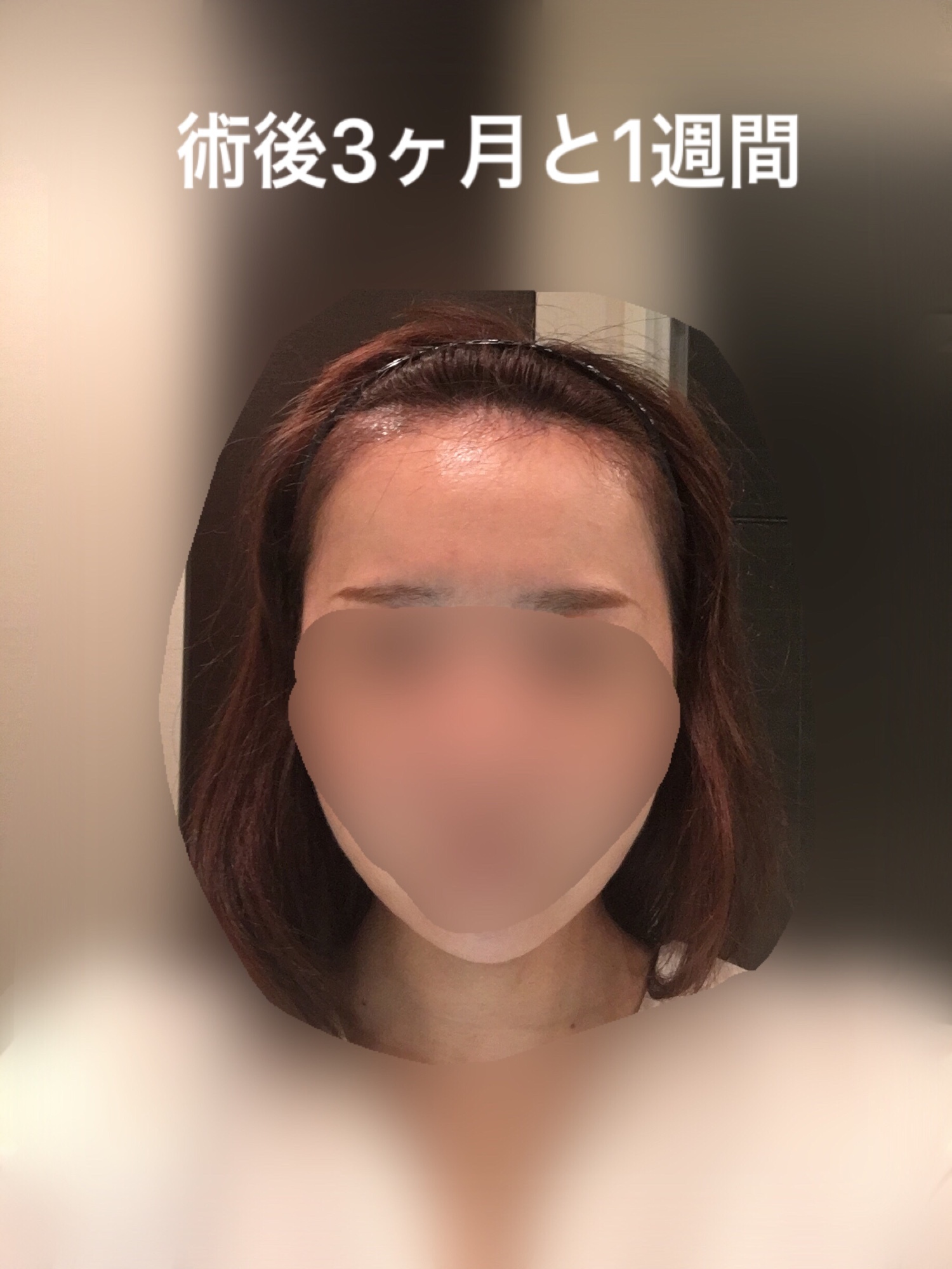 術後５ヶ月までのまとめ_d0367324_16104444.jpeg