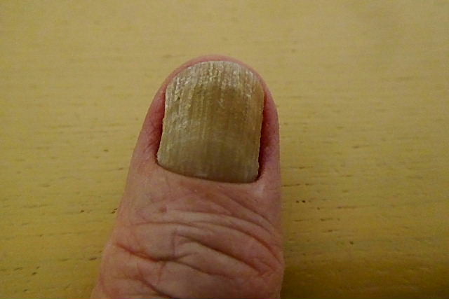 厚硬爪甲 こうこうそうこう 風の向くまま 厚硬爪甲 こうこうそうこう 風の向くまま