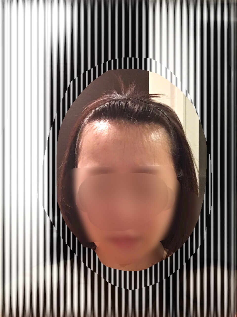 術後５ヶ月までのまとめ_d0367324_13511581.jpg