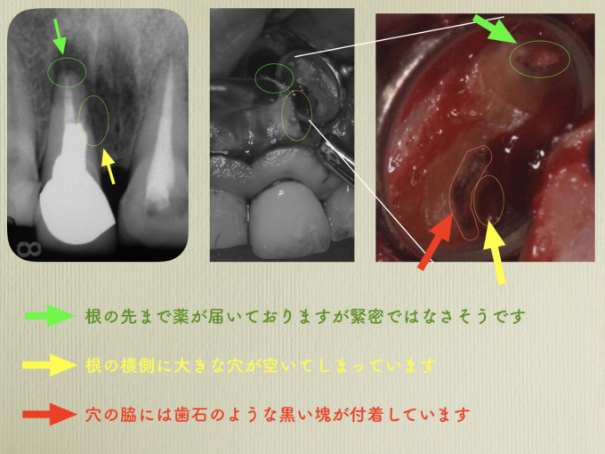 a0140882_15233980.jpeg