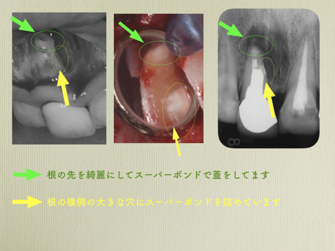 a0140882_15234030.jpeg