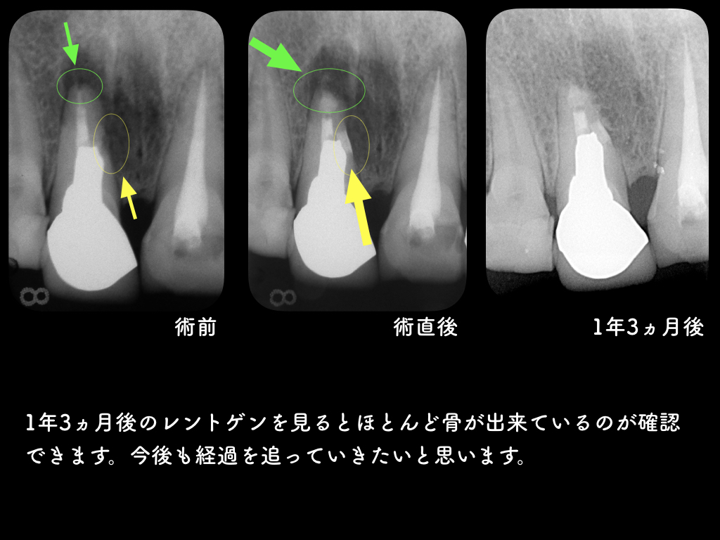 a0140882_15234108.jpeg
