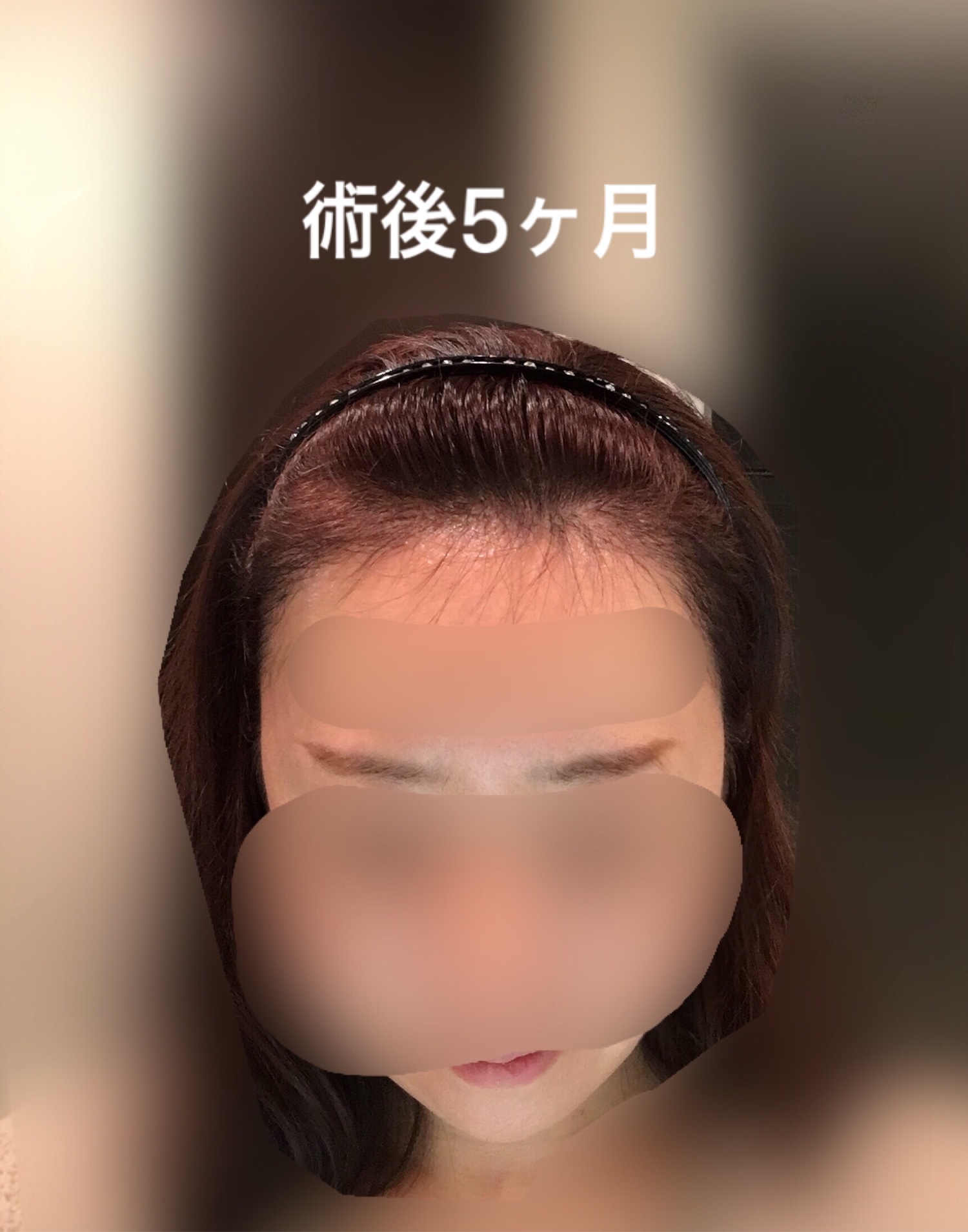 術後５ヶ月までのまとめ_d0367324_13200460.jpeg