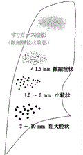 d0364500_21010243.gif