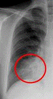 d0364500_21214414.gif