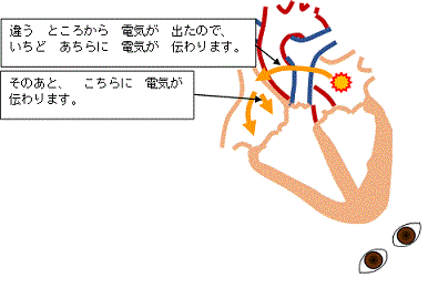 一般健康診断（２２）＠労働安全衛生法_d0364500_19584243.gif