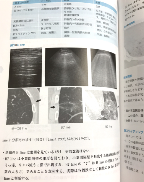書籍の紹介:内科病棟・ER トラブルシューティング_e0156318_9131044.png