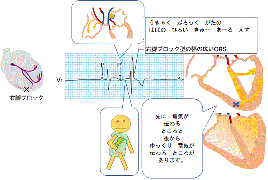 一般健康診断（４１）＠労働安全衛生法_d0364500_18520175.gif