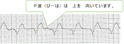 一般健康診断（３３）＠労働安全衛生法_d0364500_02234174.gif