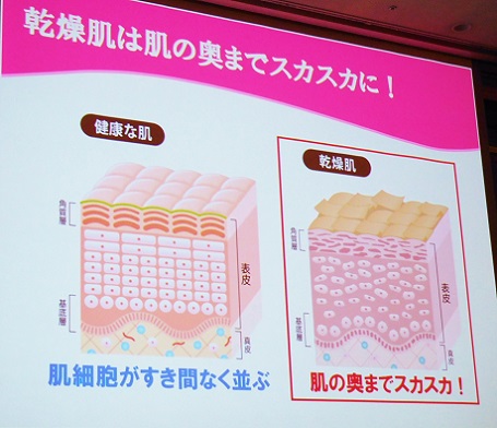 【第60回 RSP in 品川】小林製薬/Saiki治療クリーム_d0129601_2030511.jpg