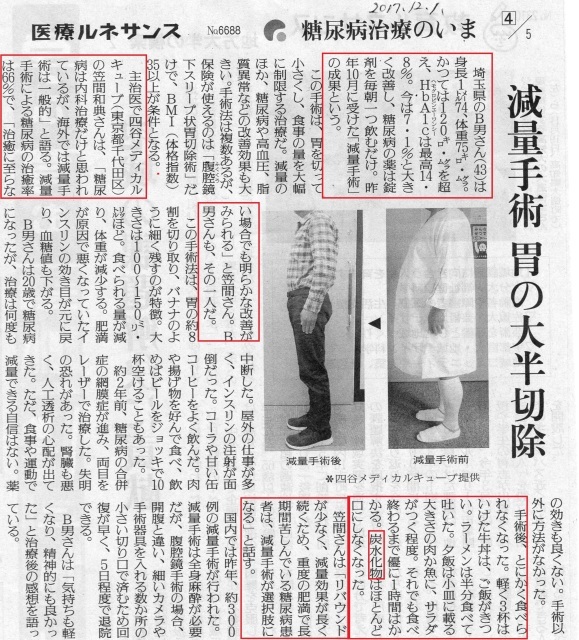 腹腔鏡下スリーブ状胃切除術 白血球数にこだわっています