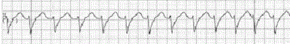 一般健康診断（４１）＠労働安全衛生法_d0364500_21233976.gif