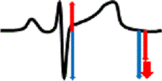 d0364500_18483905.gif