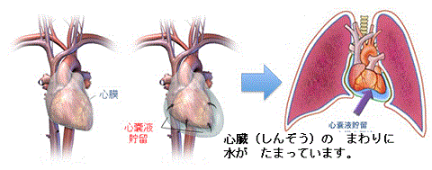 一般健康診断（４７）＠労働安全衛生法_d0364500_21124788.gif