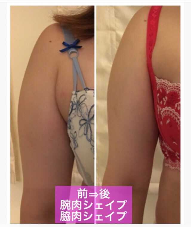 太めの二の腕 実はおっぱいのお肉が流れてる って本当 やせても下がってたるんだ体は魅力減 ただやせただけの残念なボディラインより魅せるボディを作りませんか 素敵女性育成メソッド 上向き思考で楽しく生きる 太めの二の腕 実はおっぱいのお肉が流れてる って本当 やせても下がってたるんだ体は魅力減 ただやせただけの残念なボディラインより魅せるボディを作りませんか 素敵女性育成メソッド 上向き思考で楽しく生きる