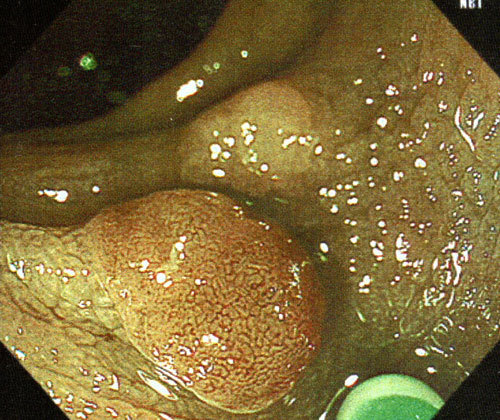 c0039487_11360838.jpg