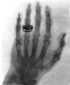 e0126350_12164700.gif