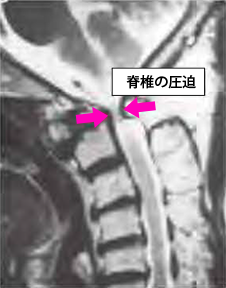 a0296269_16452329.png