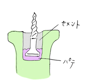 e0330420_00252809.png