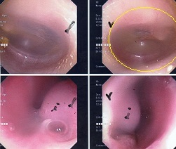 繰り返し抗微生物薬の投薬は・・・・・・・_a0082724_19060603.jpg