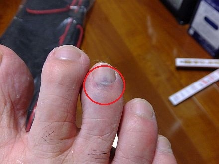 パワステフルード 足の指に落下 いてぇ 青いそらの下で