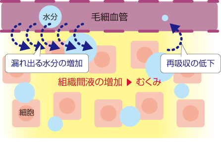 体重増加!原因は?_b0328361_23242432.jpeg