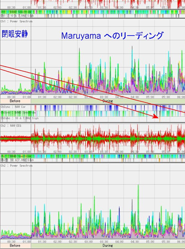 脳波研究の第一人者である志賀工学博士に脳波を測定していただきました(1)_d0169072_16014647.jpg