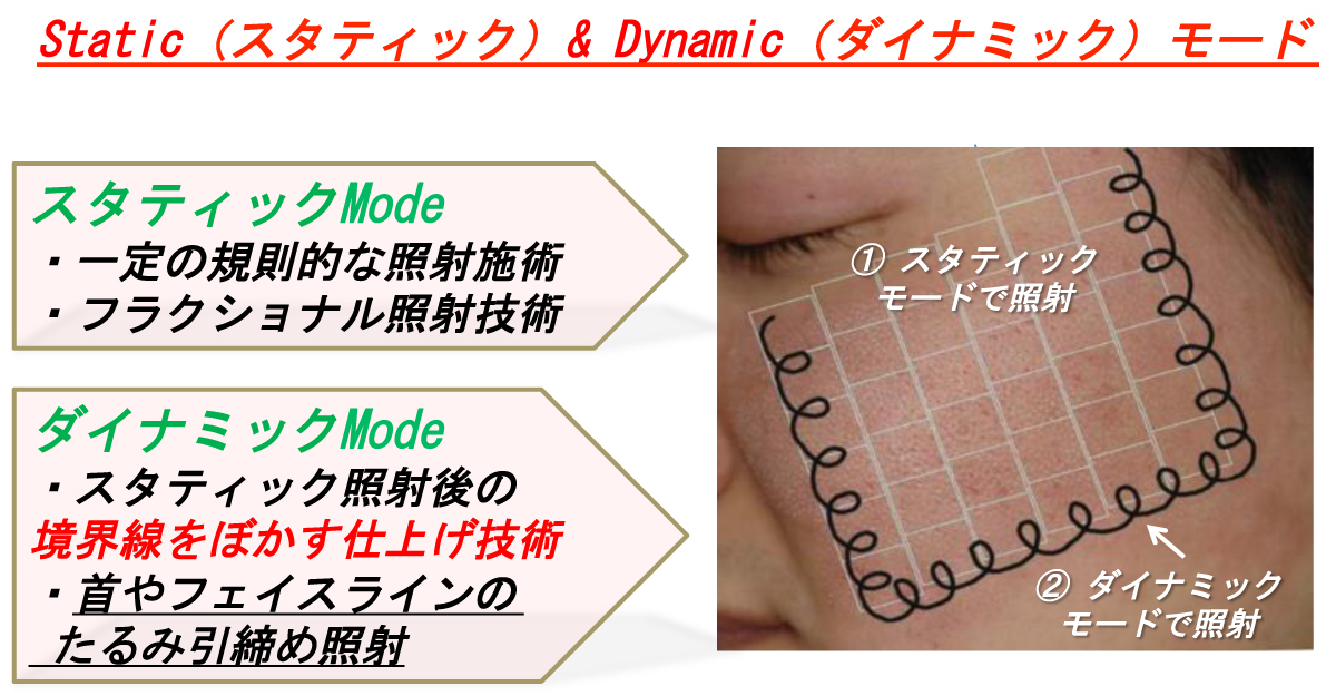 新たなフラクショナルレーザー導入_d0105660_15063137.jpg