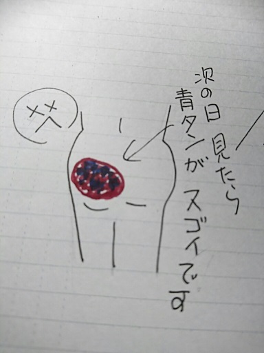 階段から 落ちまして ぽんぽこの絵手紙 字手紙 消しゴムはんこ 階段から 落ちまして ぽんぽこの絵手紙 字手紙 消しゴムはんこ