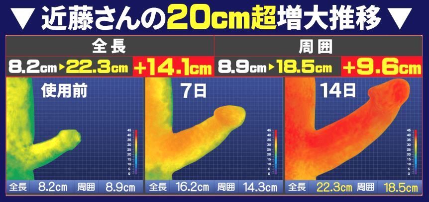 GNT-α 口コミ 【悲報】大きくなりすぎて服用を中止するも戻らず… : GNT-α