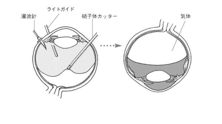 f0091250_117569.png