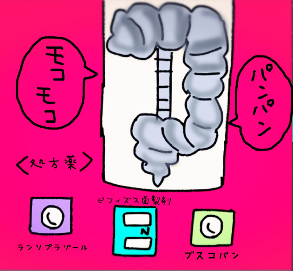 腹部CT検査も体験_b0392383_13280512.jpg