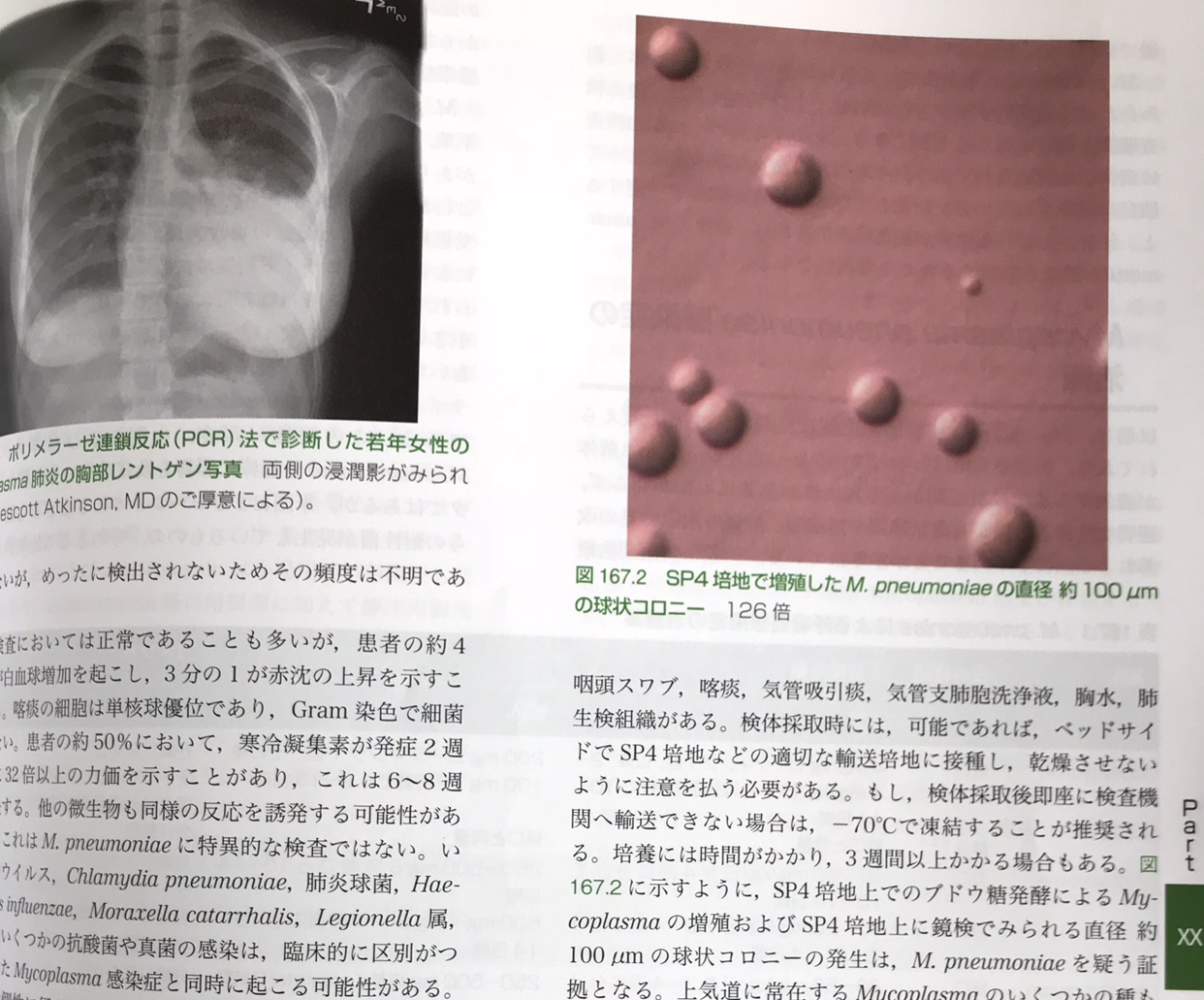 本の紹介：シュロスバーグの臨床感染症学 : 呼吸器内科医