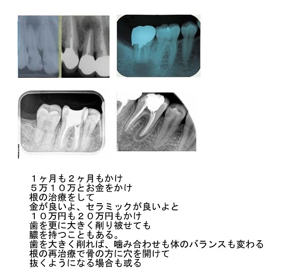 d0338857_04521740.jpg