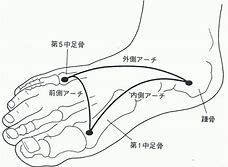 あなたの足の痛みの原因は？足のトラブルと運動_b0179402_12081327.jpg