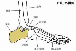 あなたの足の痛みの原因は？足のトラブルと運動_b0179402_12112820.jpg