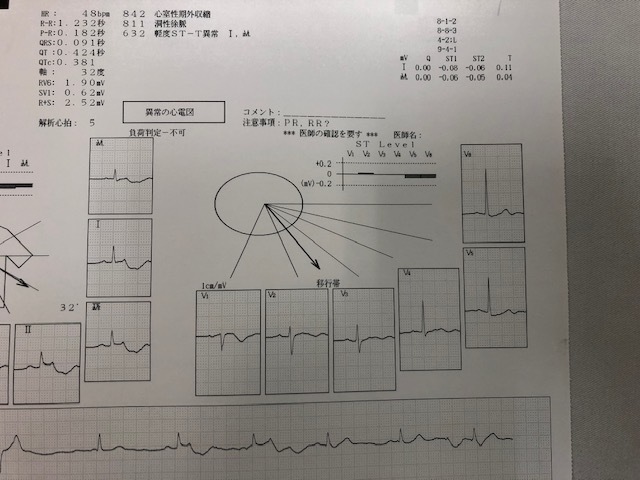 f0333882_16260931.jpg