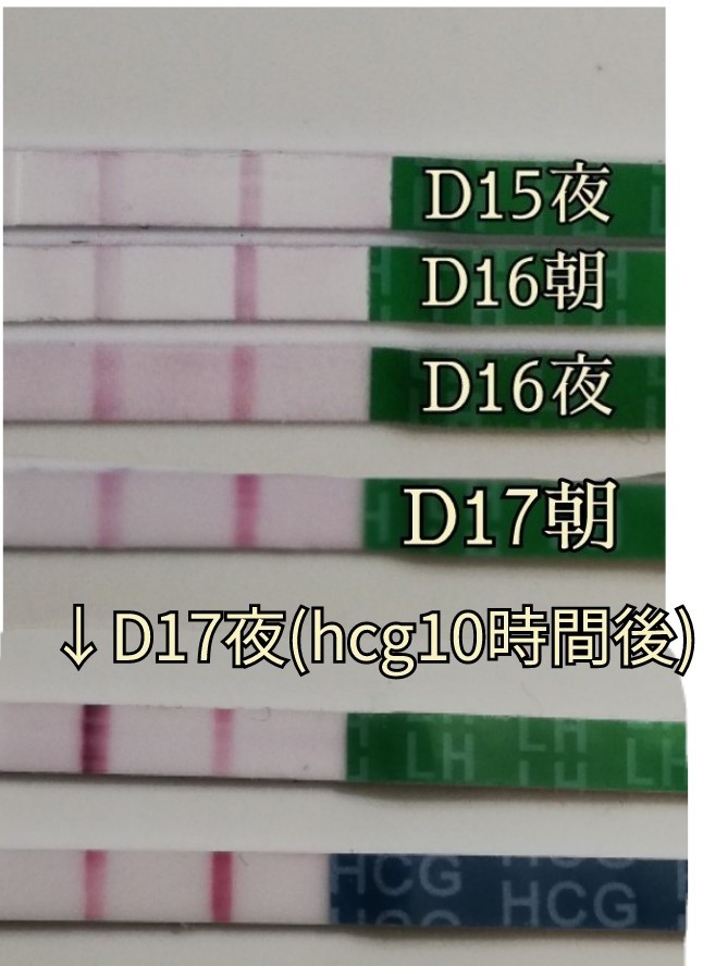 D17  卵胞チェック& hcg注射_e0346573_18533526.jpg