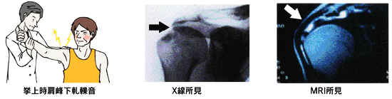a0296269_09211912.gif