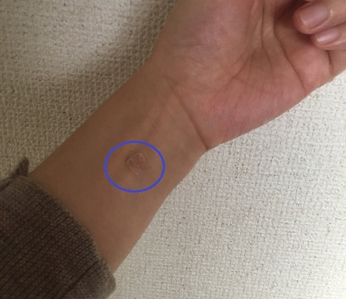 つわりに効くツボ 40歳体外 育休 復職 同居できるかな日記 つわりに効くツボ 40歳体外 育休 復職 同居できるかな日記