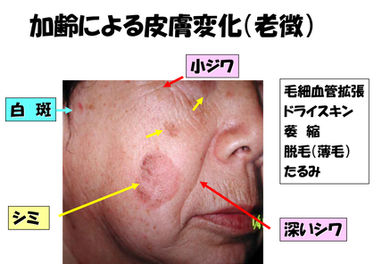 2019年2月教室『長寿と皮膚：皮膚からみる老化のサイン、長寿のサイン』_c0219616_18270498.png