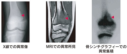 新版 骨関節のX線診断