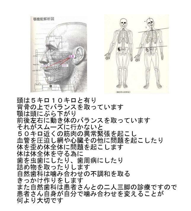 虫歯・歯周病の原因は何でしょうか_d0338857_04565689.jpg