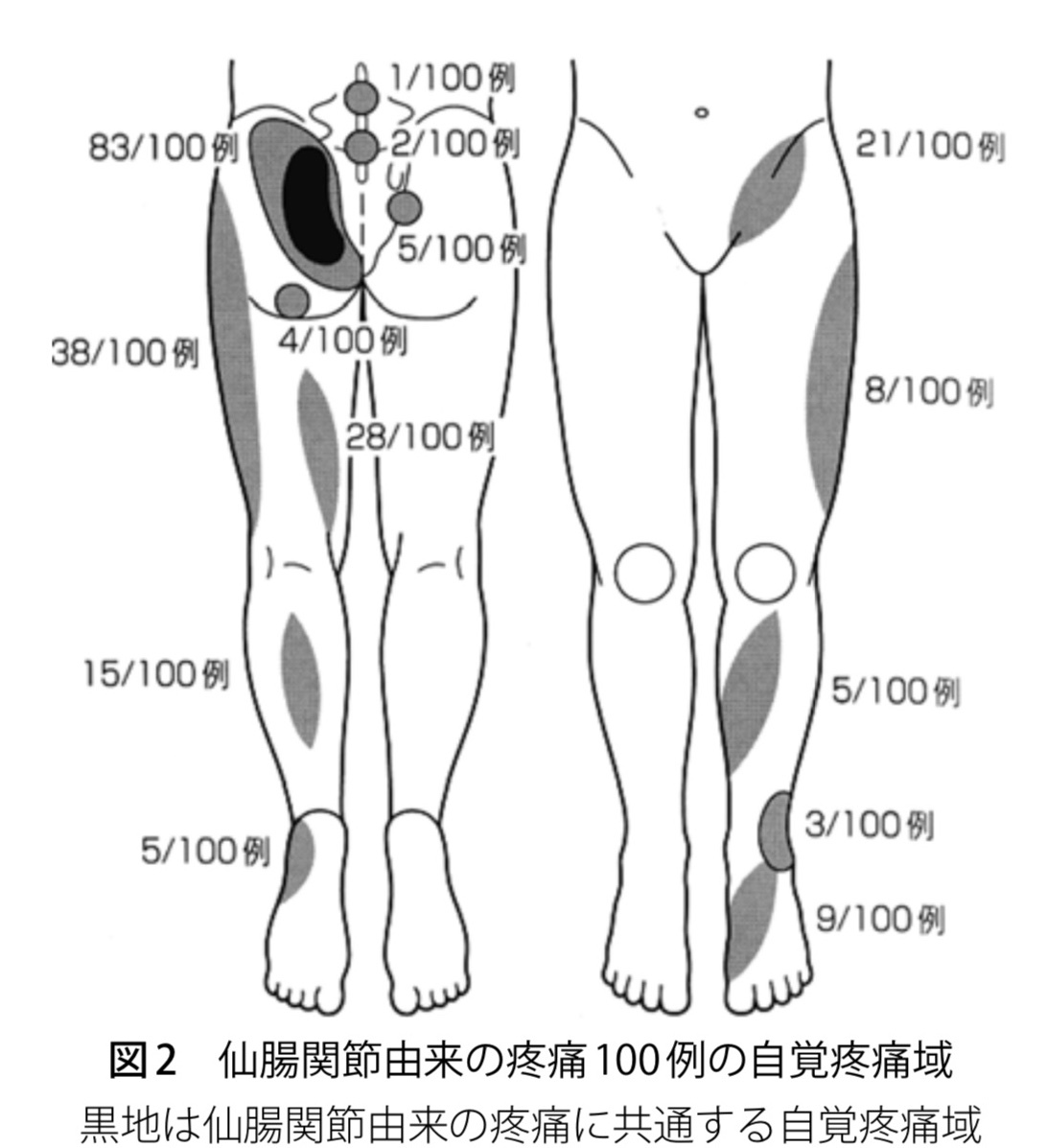 仙腸関節由来の痛み 弘明寺 原整形外科医院 のブログ 仙腸関節由来の痛み 弘明寺 原整形外科医院 のブログ