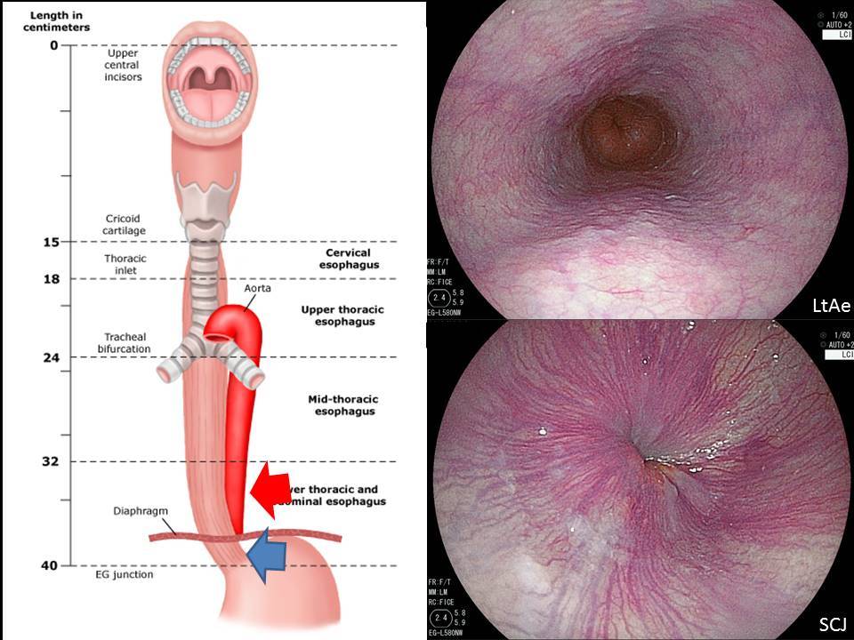 食道の解剖その２_b0180148_19292756.jpg