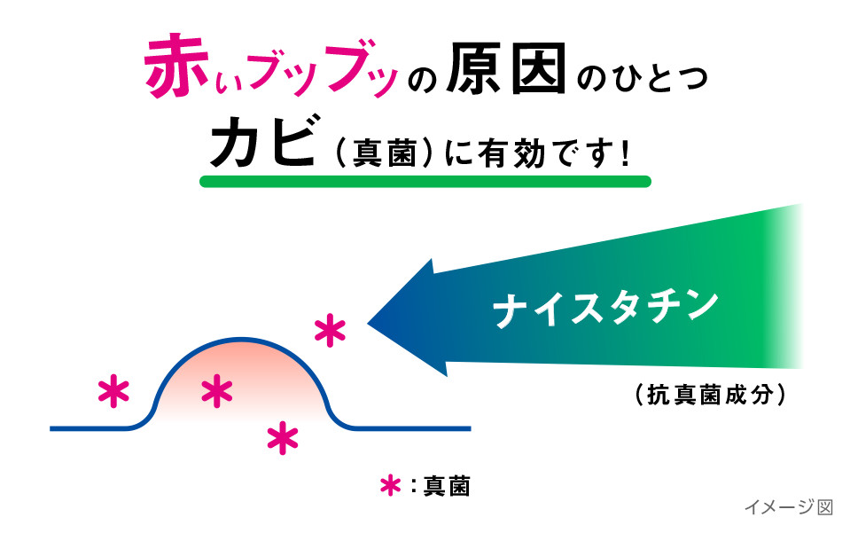 ニキビ 軟膏 クロマイ n
